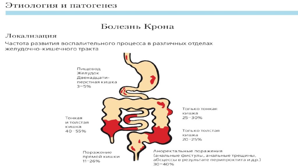 Расстройства кишечника температура