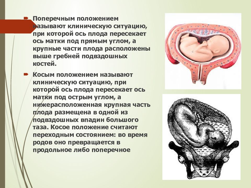 Разгибательные вставления головки презентация