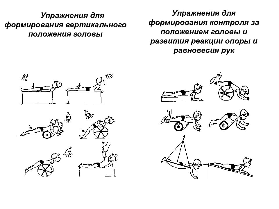 Лфк для детей с дцп презентация