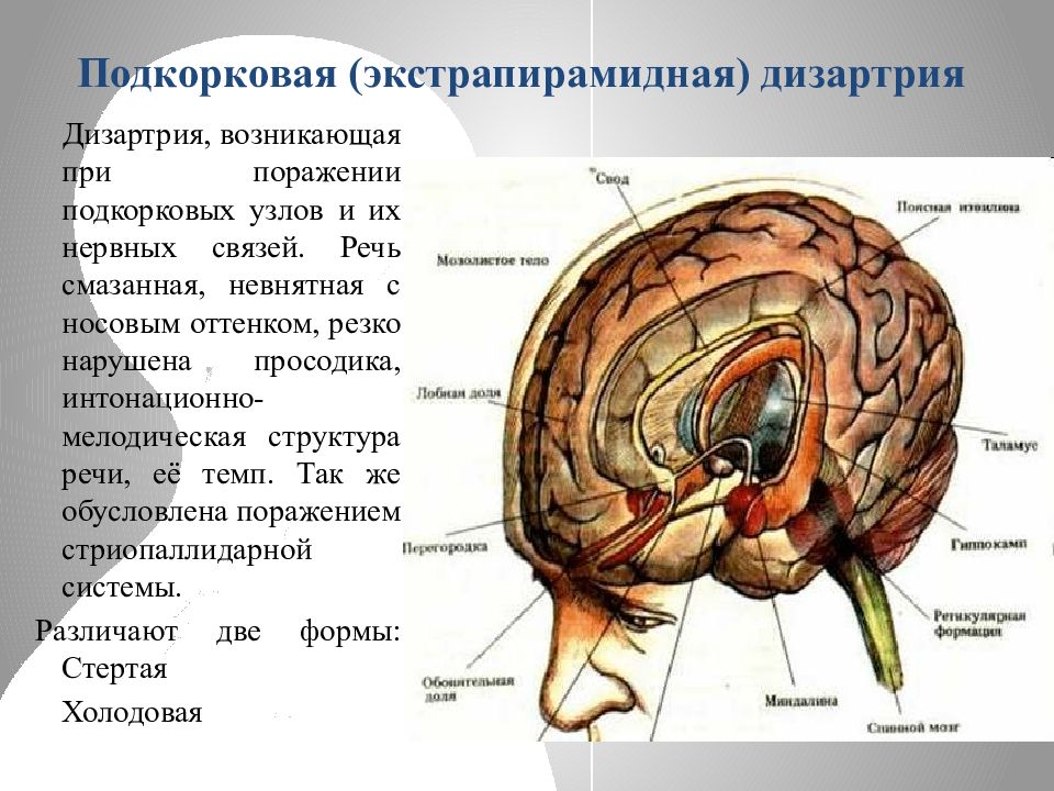 Мозжечковая дизартрия презентация