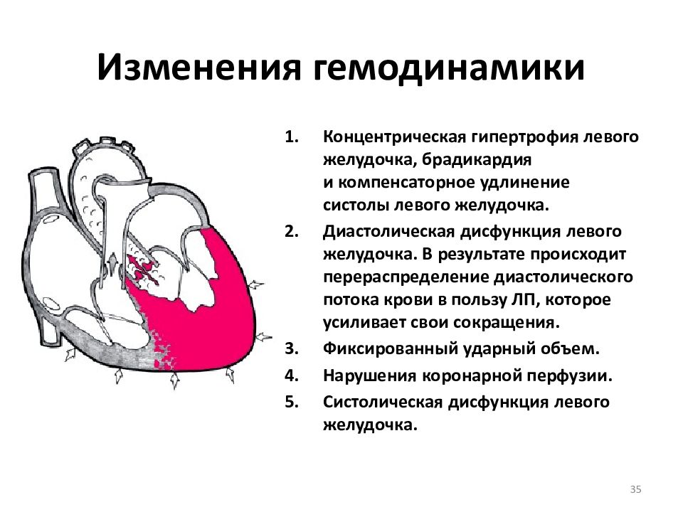 Схема гемодинамики при пороках сердца