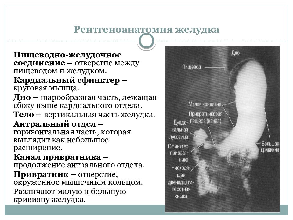 Исследования пищевода и желудка. Рентгенанатомия желудка. Рентгенологические отделы желудка. Рентгеноанатомия пищевода и желудка.