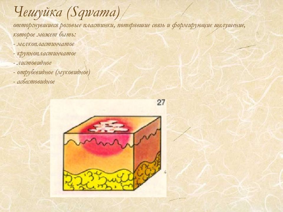 Назовите первичные элементы. Первичные и вторичные морфологические элементы кожных высыпаний. Вторичные морфологические элементы чешуйки. Полостные морфологические элементы кожи. Вторичные морфологические элементы кожи чешуйка.