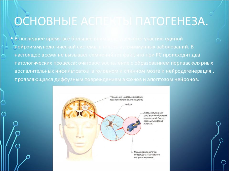 Рассеянный склероз презентация