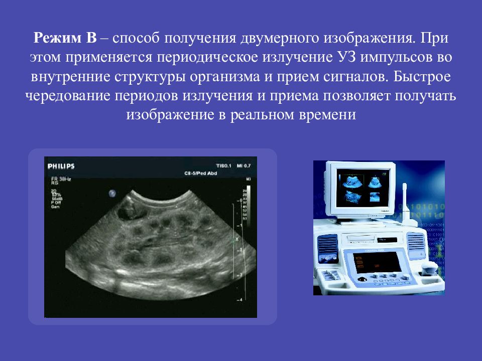 Принципы формирования уз изображения