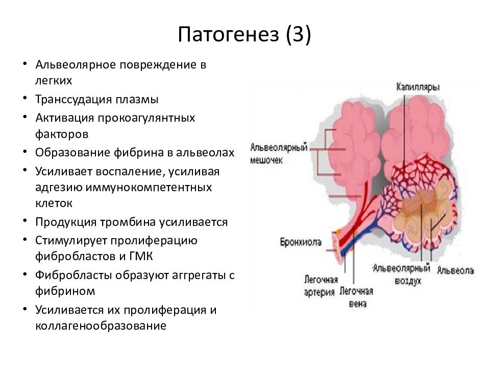 Презентация интерстициальные заболевания легких