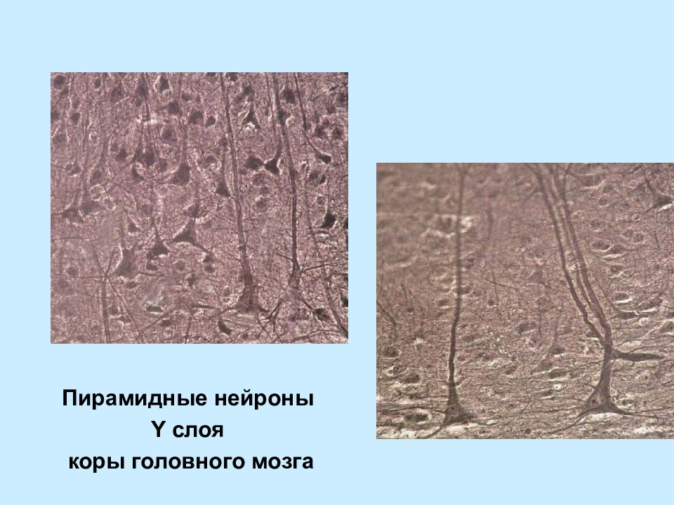 Пирамидальный Нейрон гистология. Пирамидный Нейрон (клетка Беца).. Пирамидальные клетки коры головного мозга. Пирамидные Нейроны коры гистология.
