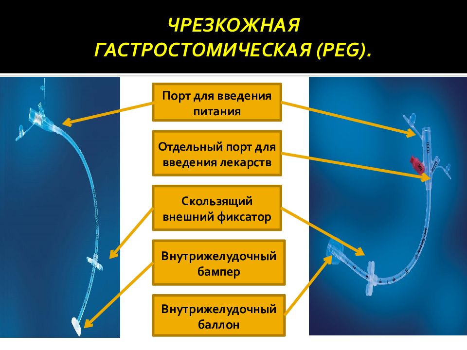 Уход за стомированными пациентами презентация