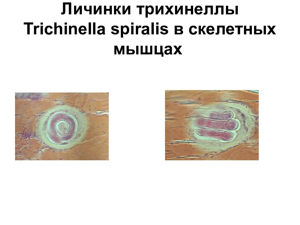 Личинки трихинеллы. Форма личинки трихинеллы. Морфология трихинеллы Trichinella spiralis. Trichinella spiralis строение. Размер личинки трихинеллы.
