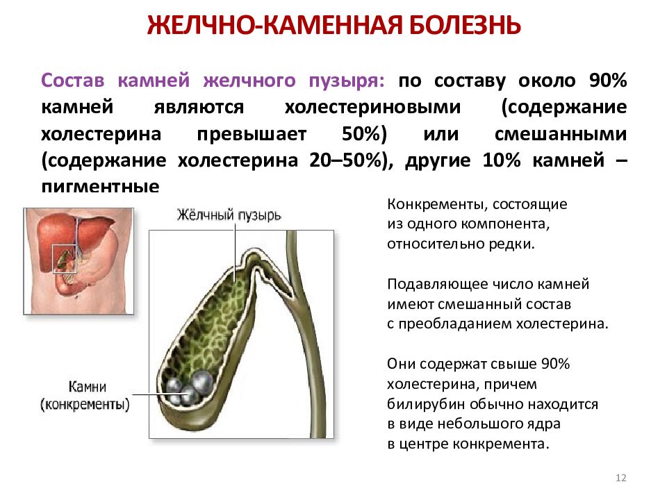 Профилактика желчнокаменной болезни презентация