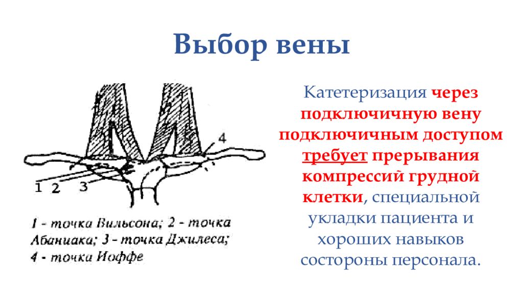 Выберите вен. Подключичная Вена катетеризация точки. Точки катетеризации подключичной вены. Катетеризация подключичной вены Иоффе. Катетеризация подключичной вены точки доступа.