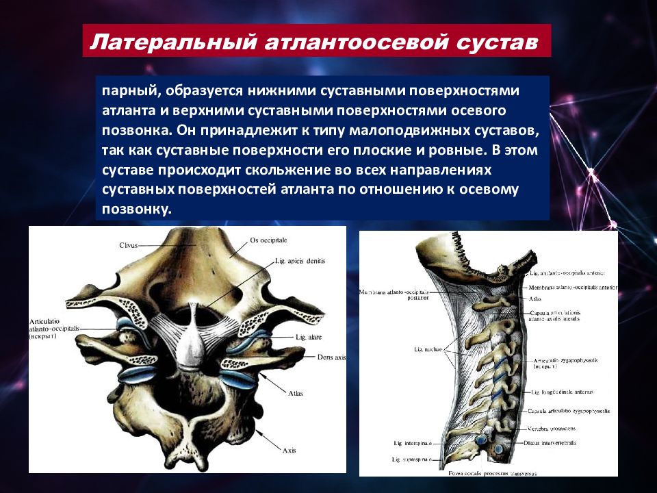 Латерально распространяющееся