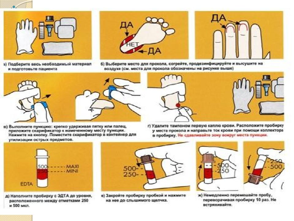 Алгоритм подготовка пациента. Лабораторные методы исследования памятка пациенту. Подготовка пациента к лабораторным методам исследования. Подготовка к лабораторным методам исследования крови. Подготовка к лабораторным методам исследования алгоритм.