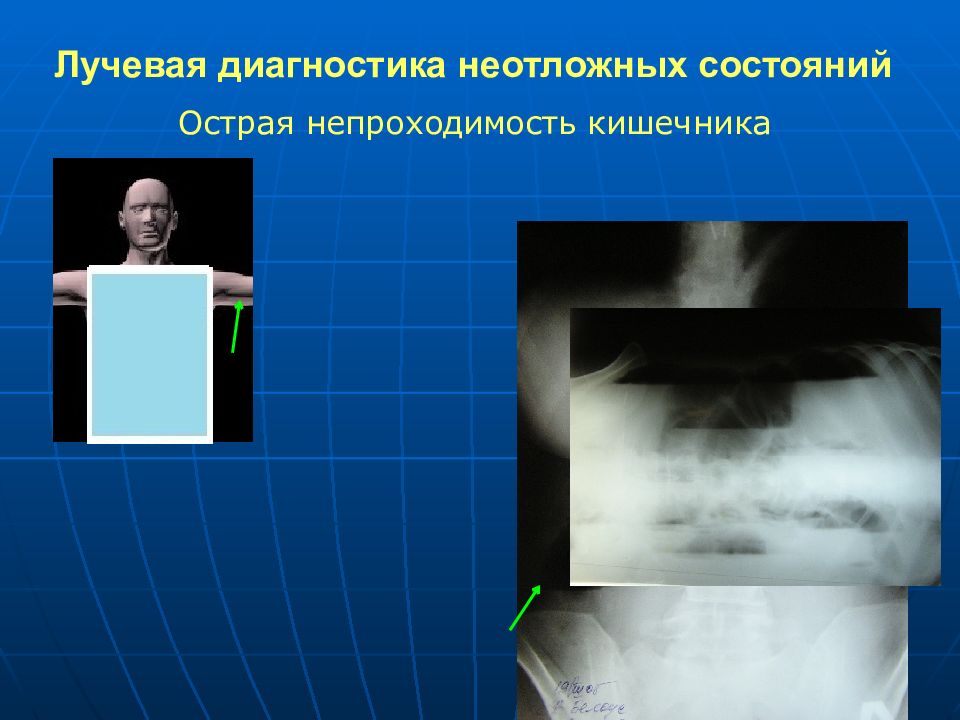 Лучевая диагностика в эндокринологии презентация