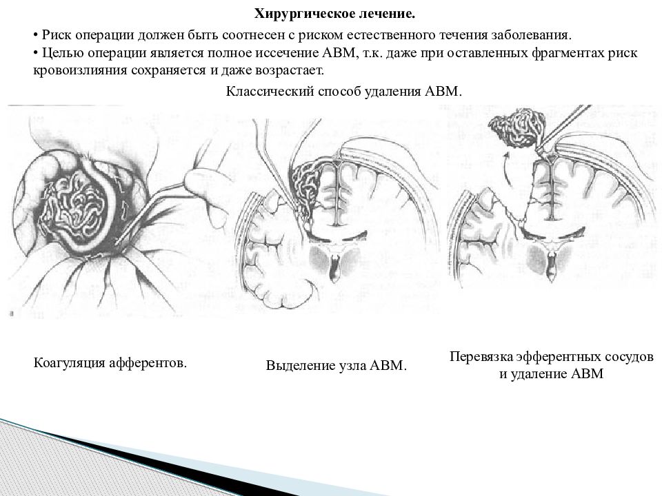 Операция является. Резекция мальформации. Операция при мальформации. Иссечение артериовенозных мальформаций.