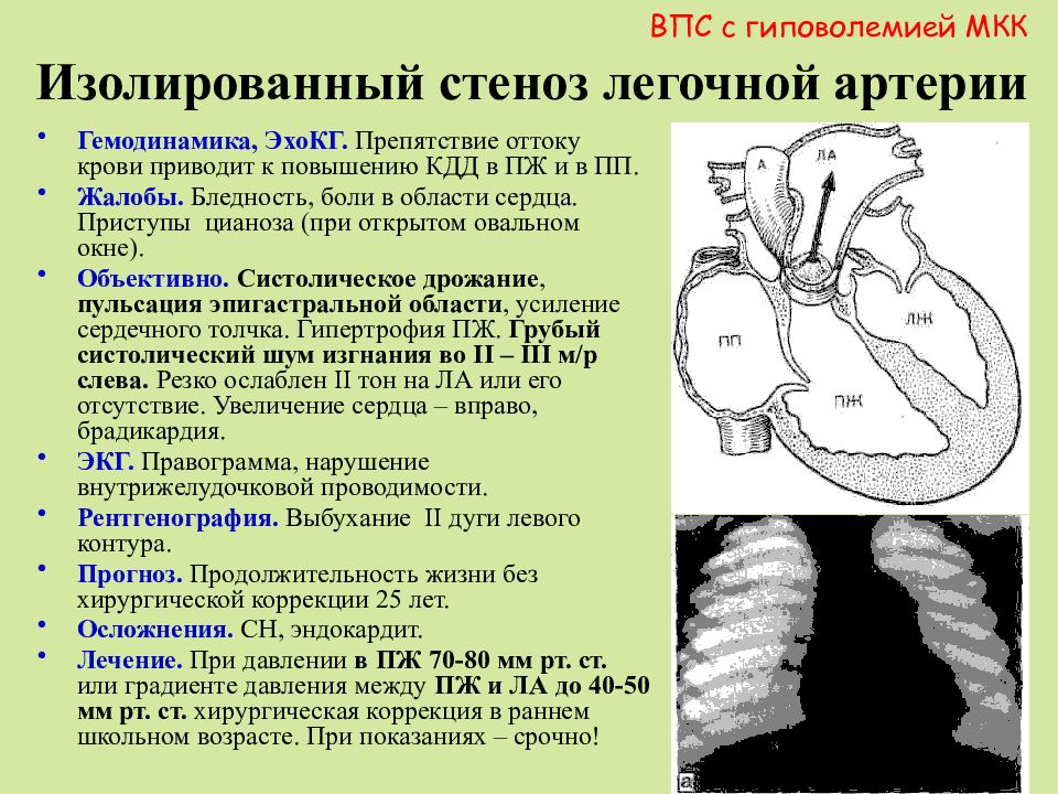 Белые пороки сердца у детей презентация