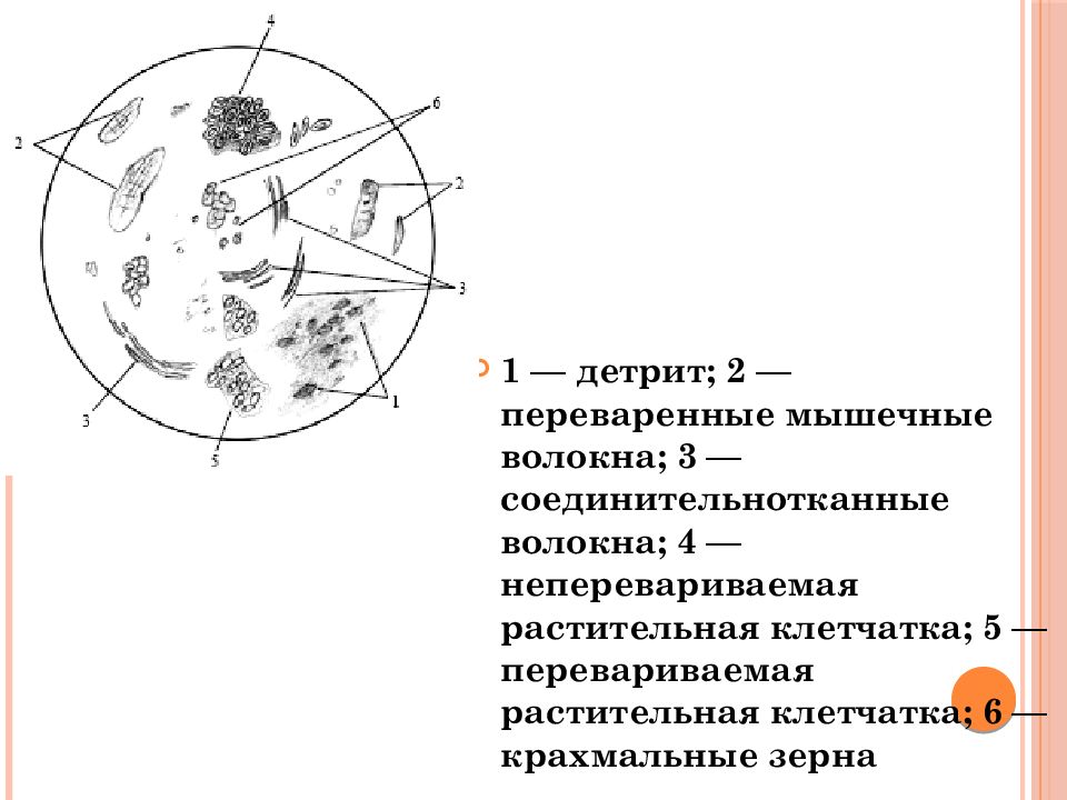 Растительная клетчатка непереваримая. Микроскопия кала растительная клетчатка непереваримая. Переваримая растительная клетчатка. Детрит. Перевариваемая клетчатка в Кале.