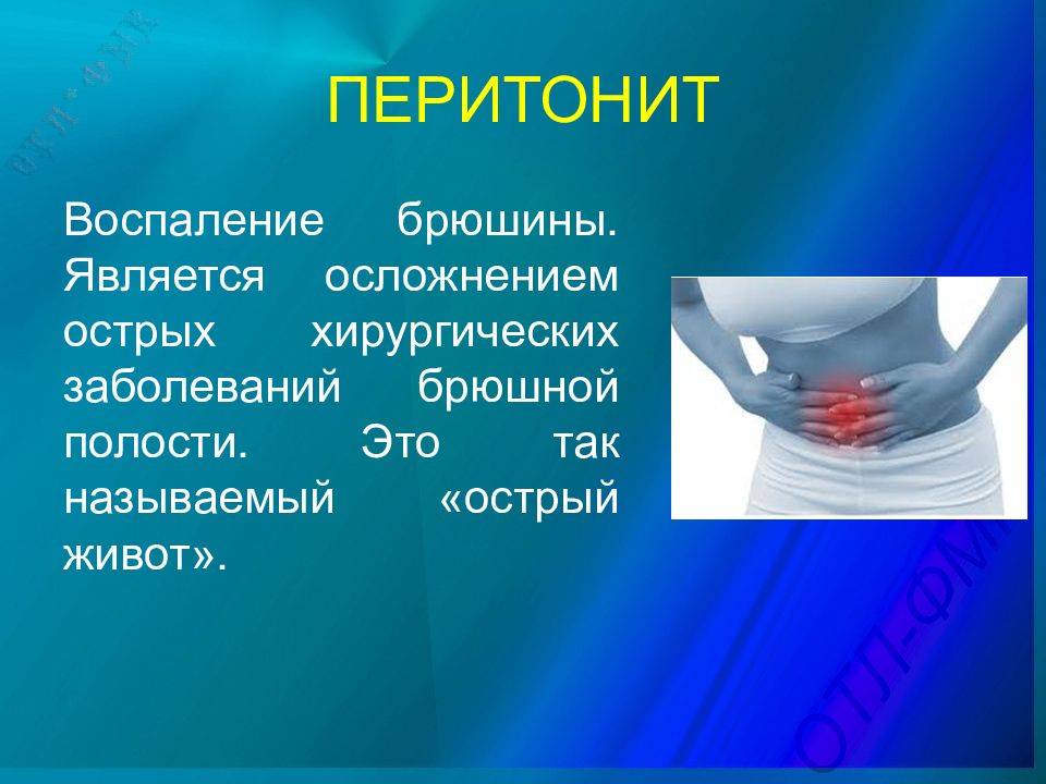 Презентация симптомы острого живота