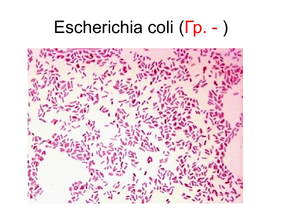 Escherichia coli обнаружено