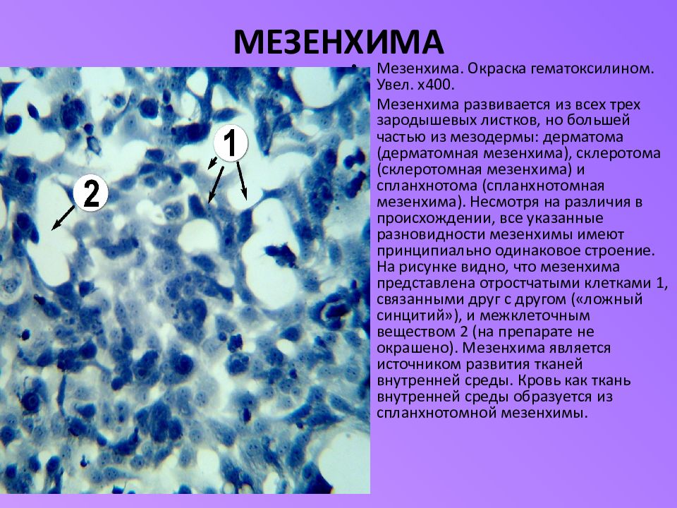 Мезенхима. Мезенхима эмбриональная соединительная ткань. Строение мезенхимы гистология. Мезенхима гистологический препарат.