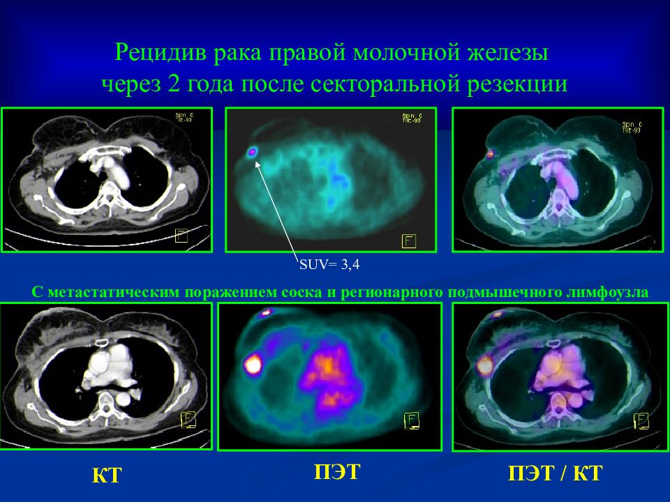 Женская радиология презентация