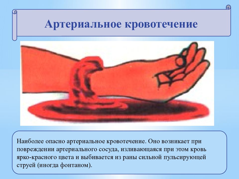 У мужчины течет кровь. Артериальное кровотечение. Опасность артериального кровотечения. Артериальное кровотечение возникает. Артериальное и венозное кровотечение.