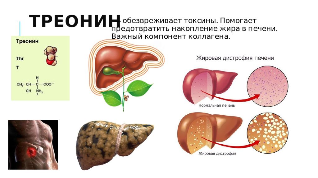 Продукты содержащие токсины. Треонин недостаток. Печень обезвреживает токсины. Накопление жира в печени. Обезвреживание токсинов в печени.