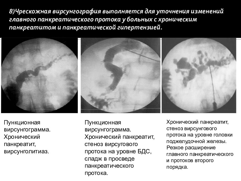 Лучевая диагностика желчевыводящих путей презентация