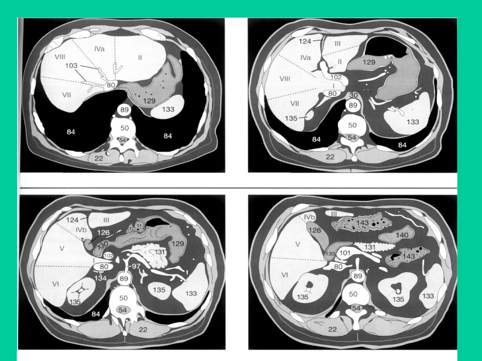 Сегменты печени кт схема