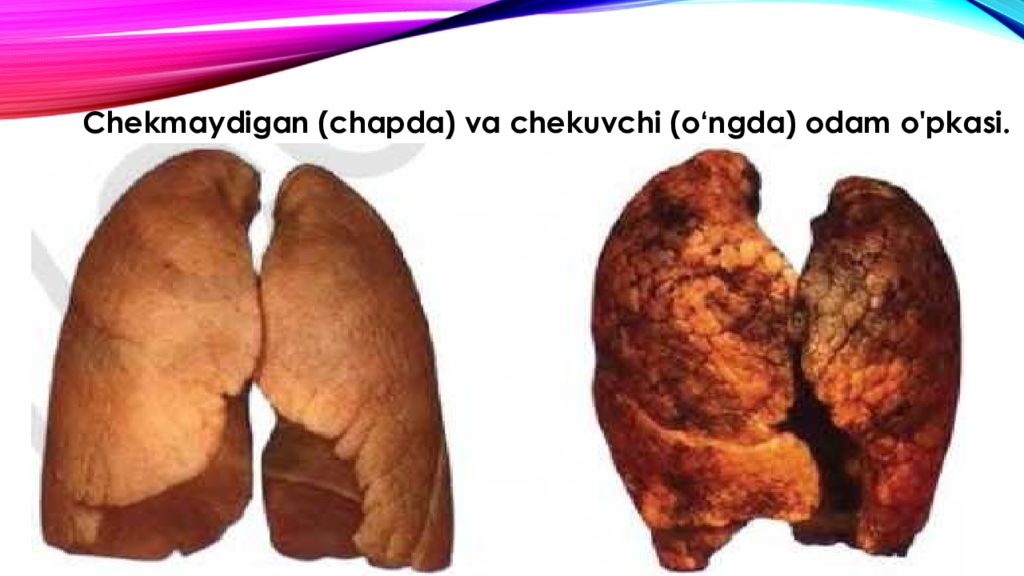 nafas olishning boshqarilishi. Nafas olish organlari kasalliklari nafas olishning boshqarilishi. Nafas olish organlari kasalliklari