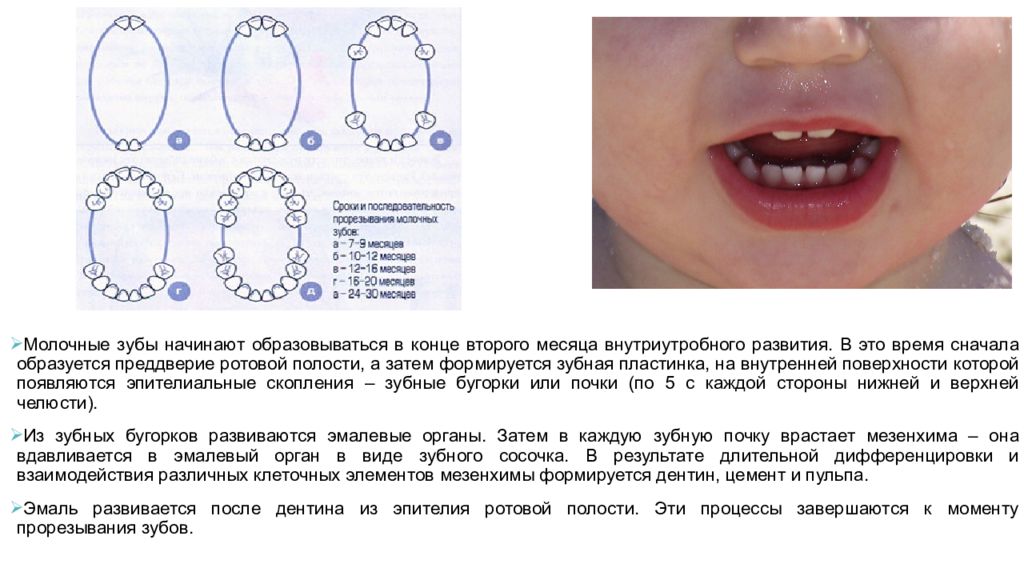 Строение молочного зуба у детей. Молочные зубы появляются. Прорезывание молочных зубов. Этапы прорезывания верхних зубов. Окончание прорезывания молочных зубов.