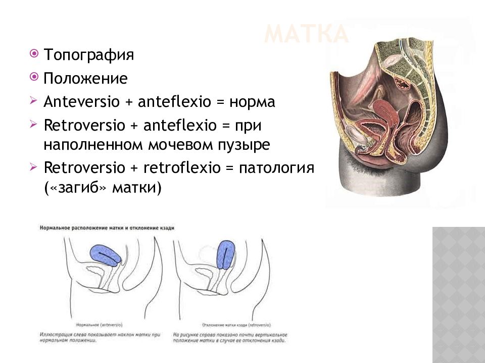 Положение тела матки. Антефлексио положение матки что это. Тело матки положение anteflexio что это. Положение матки anteflexio versio. Расположение матки anteflexio.