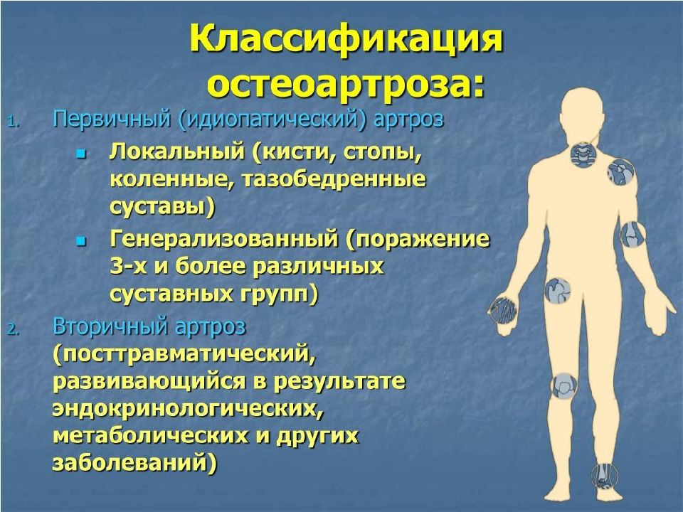 Лечение остеоартроза презентация