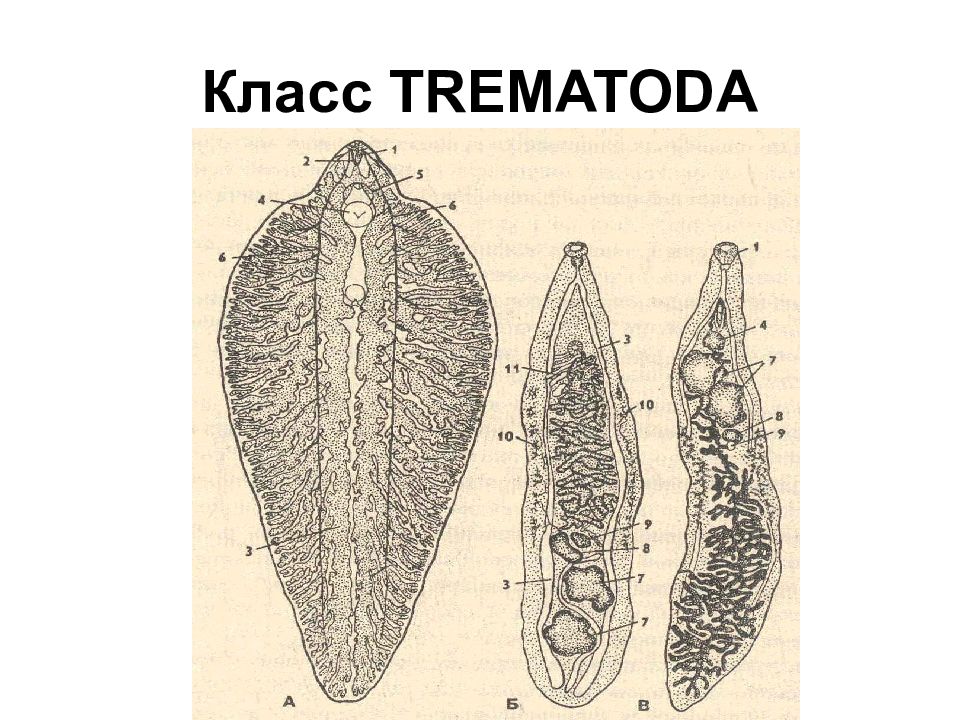 Червь сосальщик. Класс трематоды (Trematoda). Дигенетические сосальщики (трематоды). Сосальщики ремантодозы.