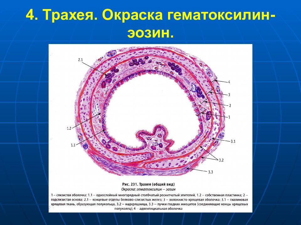 По изображению с микроскопа в препарате трахеи окрашенной гематоксилином и эозином