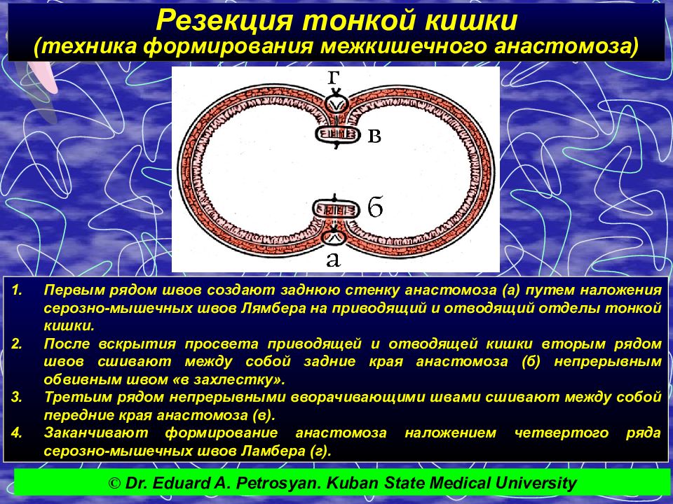 Что находится в зонах обозначенных на рисунке фрагмента тонкой кишки