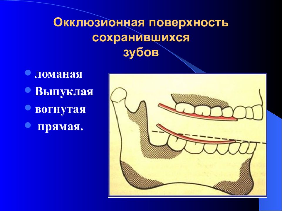 Окклюзионная кривая Шпее. Окклюзионная поверхность. Окклюзионная плоскость. Окклюзионная плоскость и поверхность.