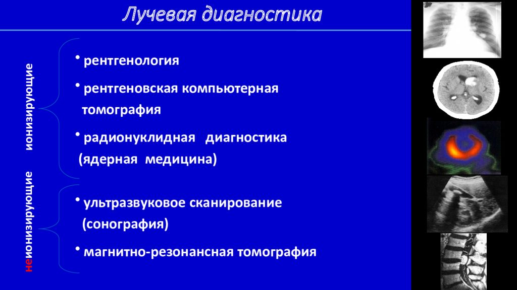 Лучевая диагностика это. Лучевая диагностика. Основные принципы лучевой диагностики. Рентгенологический метод лучевой диагностики. Принципы в лучевой диагностике.