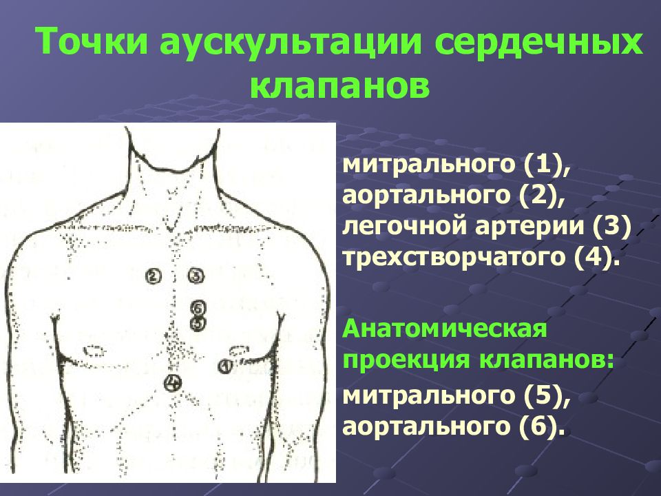 Точки аускультации сердца рисунок