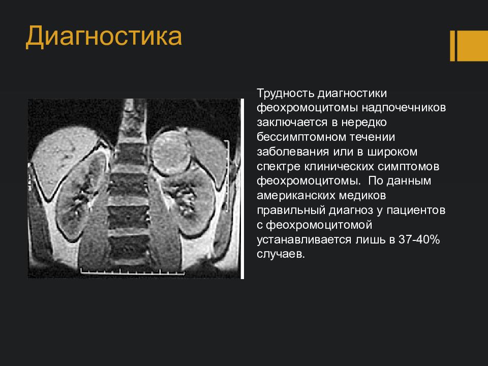 Феохромоцитома план обследования