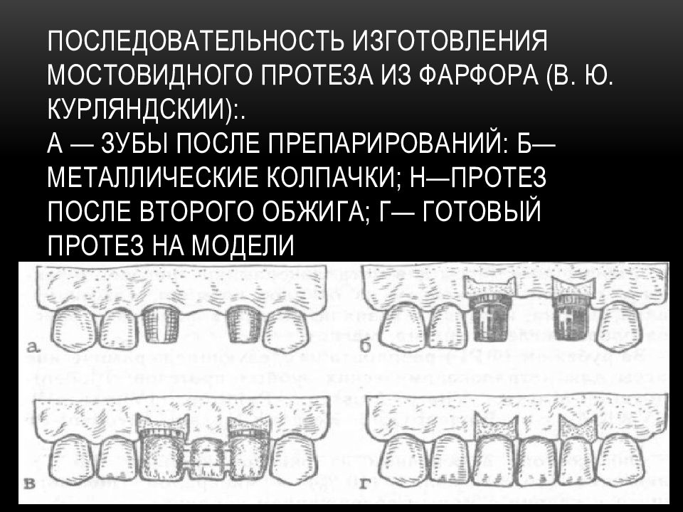 Способы индивидуализации несъемных реставраций зубов презентация