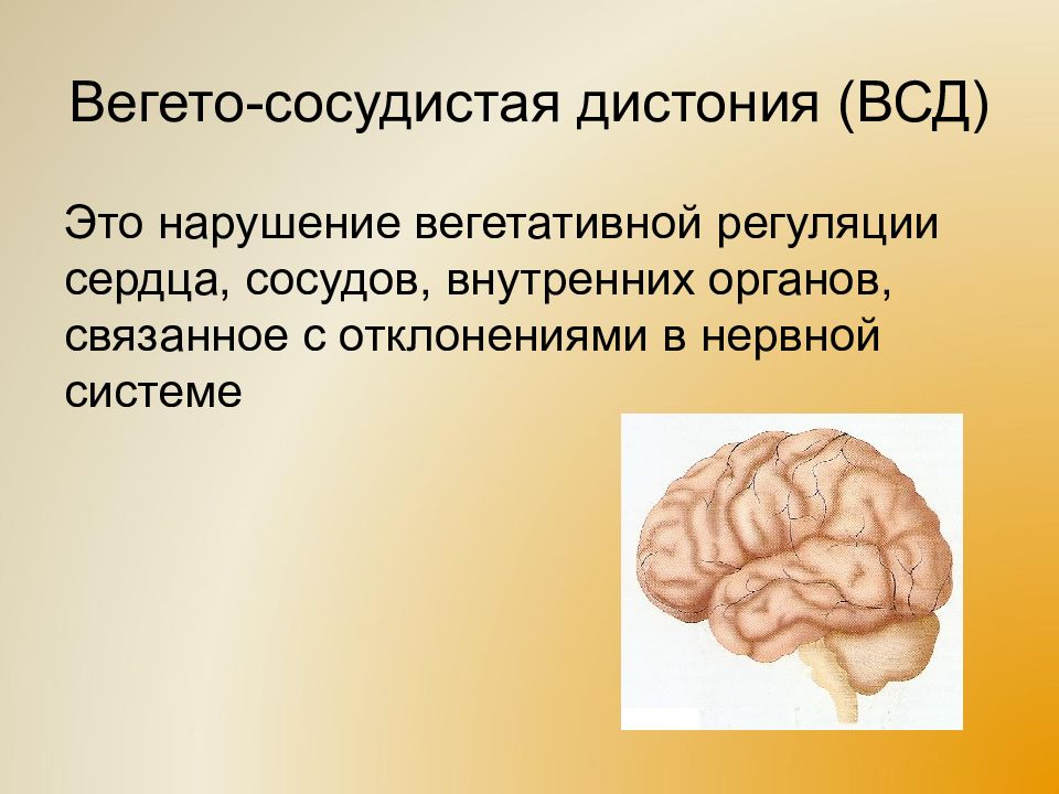 Всд это. Вегетососудистая дистония. Дистония вегетотсосудистая. Нарушение вегето сосудистой системы. ВСД это болезнь.