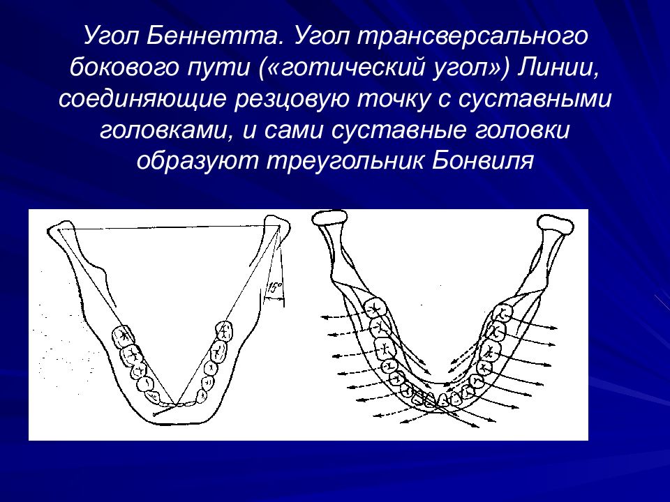 Готический угол