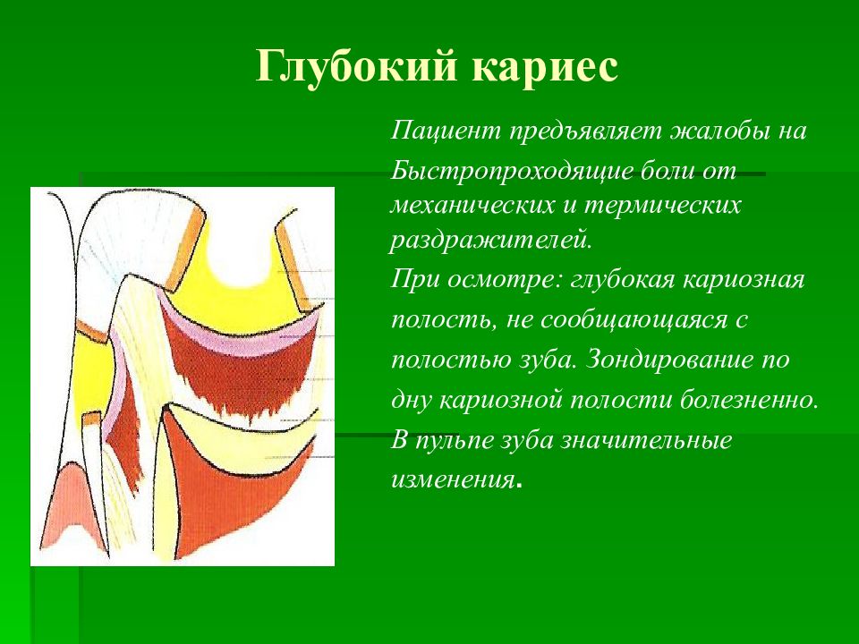 Зондирование болезненно по дну и стенкам полости