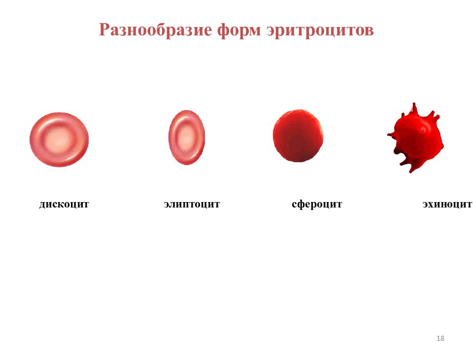 Форма эритроцитов человека. Формы эритроцитов эхиноциты сфероциты. Патологические формы эритроцитов. Стареющие формы эритроцитов. Изменение величины эритроцитов.