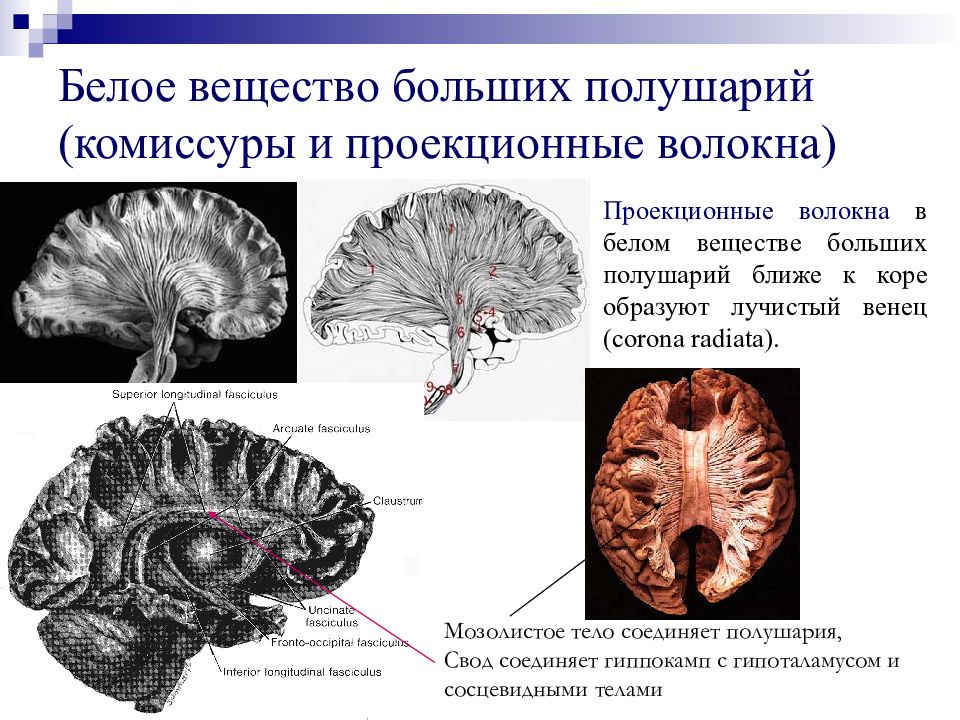 Волокна мозга. Комиссуры ГМ. Белое вещество больших полушарий. Проекционные волокна головного мозга. Комиссуры мозга.