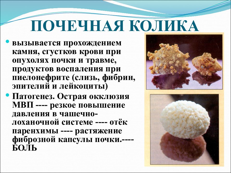 Почечная колика сестринская карта