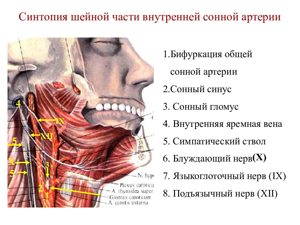 Синтопия это. Бифуркация сонной артерии на уровне. Уровень бифуркации общей сонной артерии. Место бифуркации общей сонной артерии. Трифуркация общей сонной артерии.