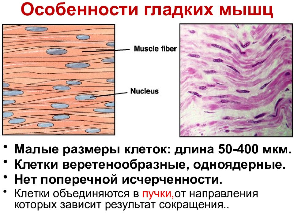 Состоит из клеток имеющих поперечную исчерченность. Веретенообразные клетки. Веретенообразная форма клетки. Базальная исчерченность. Опухолевые мышечные клетки веретенообразной формы.
