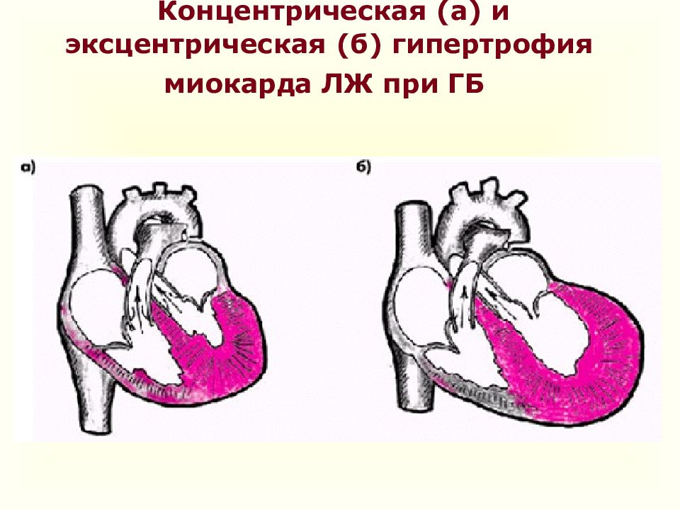 Ісіну синдромы презентация